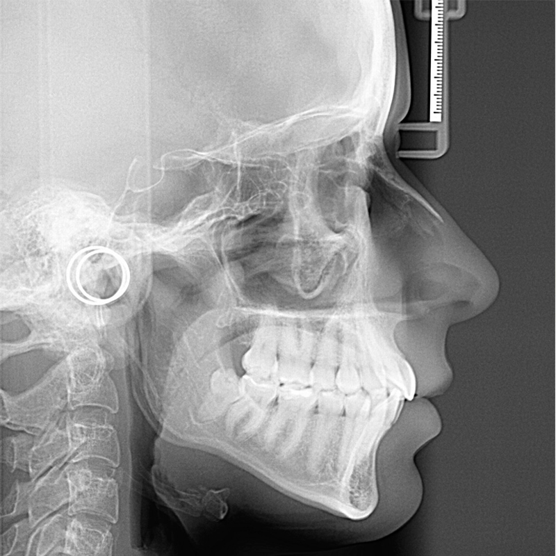 Radiografias